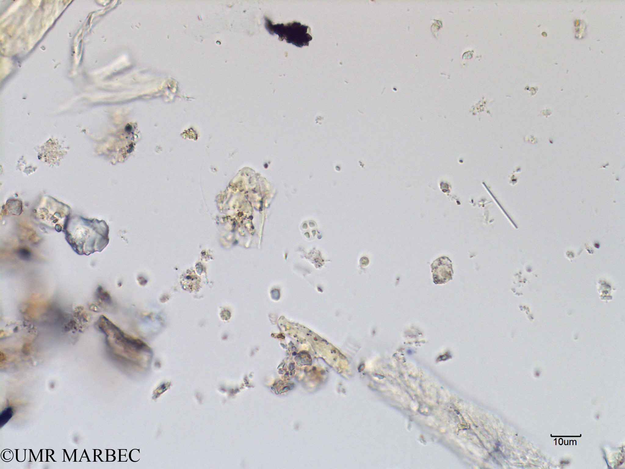 phyto/Scattered_Islands/mayotte_lagoon/SIREME May 2016/Gloeocapsa sp2 (MAY2_chroococcale-3).tif(copy).jpg